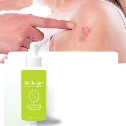 ✨ Skinrenew Scar Repair Essence – Pack of 2