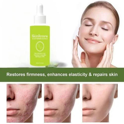 ✨ Skinrenew Scar Repair Essence – Pack of 2