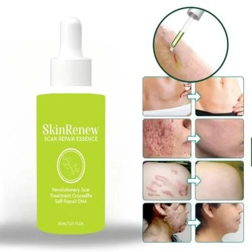✨ Skinrenew Scar Repair Essence – Pack of 2